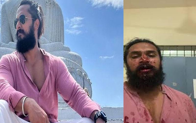 Un acteur indien bien connu a été attaqué par des personnes en colère et s’est cassé la clavicule