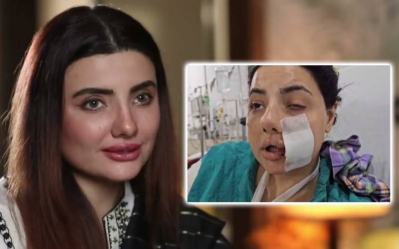 قاتلانہ حملے کے بعدسابق اداکارہ زینب جمیل کاردعمل سامنے آگیا 